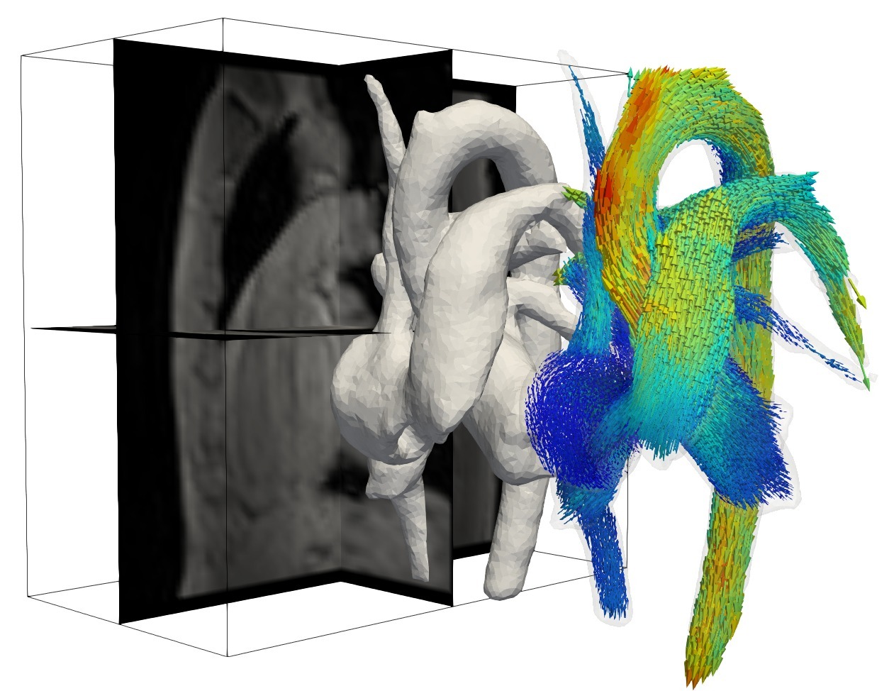 Académico desarrolla plataforma de análisis automatizado para el diagnóstico de enfermedades cardiovasculares Académico desarrolla plataforma de análisis automatizado para el diagnóstico de enfermedades cardiovasculares